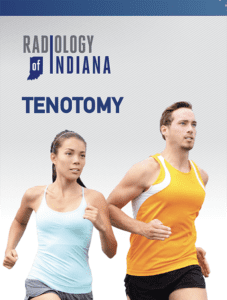treatment for tenotomy radiology brochure
