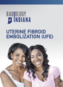 treatment for UFE radiology brochure