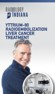 treatment for yttrium radiology treatment