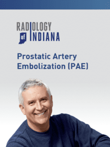 treatment for Prostatic Artery Embolization (PAE) radiology brochure