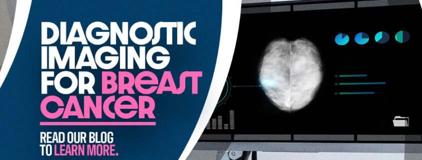 Diagnostic imaging for breast cancer - read our blog to learn more!
