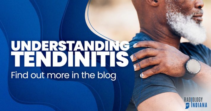 Understanding Tendinitis - find out more in our blog!
