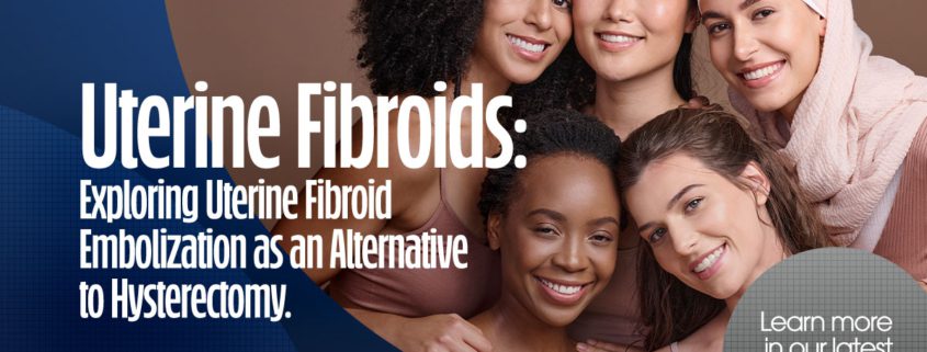 Uterine Fibroids: Exploring Uterine Fibroid Embolization as an Alternative to Hysterectomy