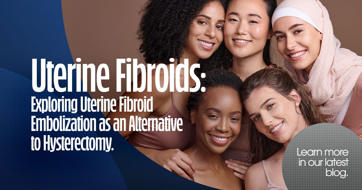 Uterine Fibroids: Exploring Uterine Fibroid Embolization as an Alternative to Hysterectomy