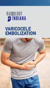 Varicocele Embolization Brochure